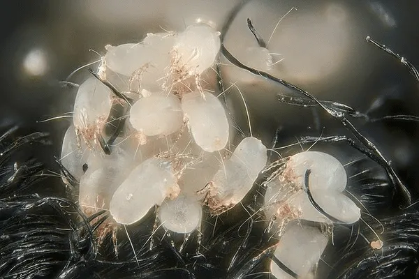 What's Living in Your Mattress: The Truth About Dust Mites