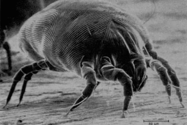 What's Living in Your Mattress: The Truth About Dust Mites